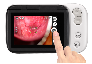 コルポカメラ | D'z IMAGE STORE カシオ医療機器 オンラインストア - CASIO